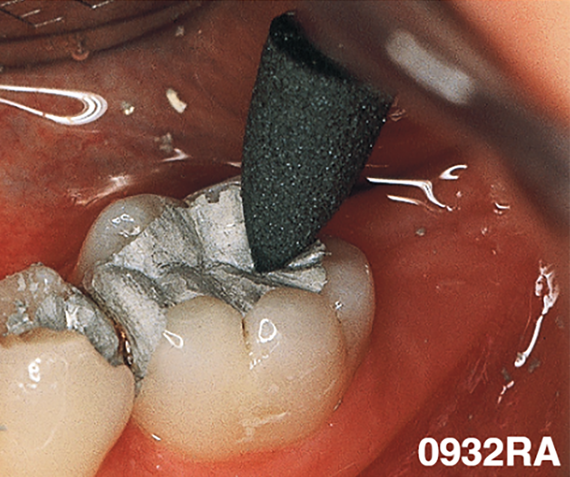 edenta South Africa - Confi-dent Clinical
