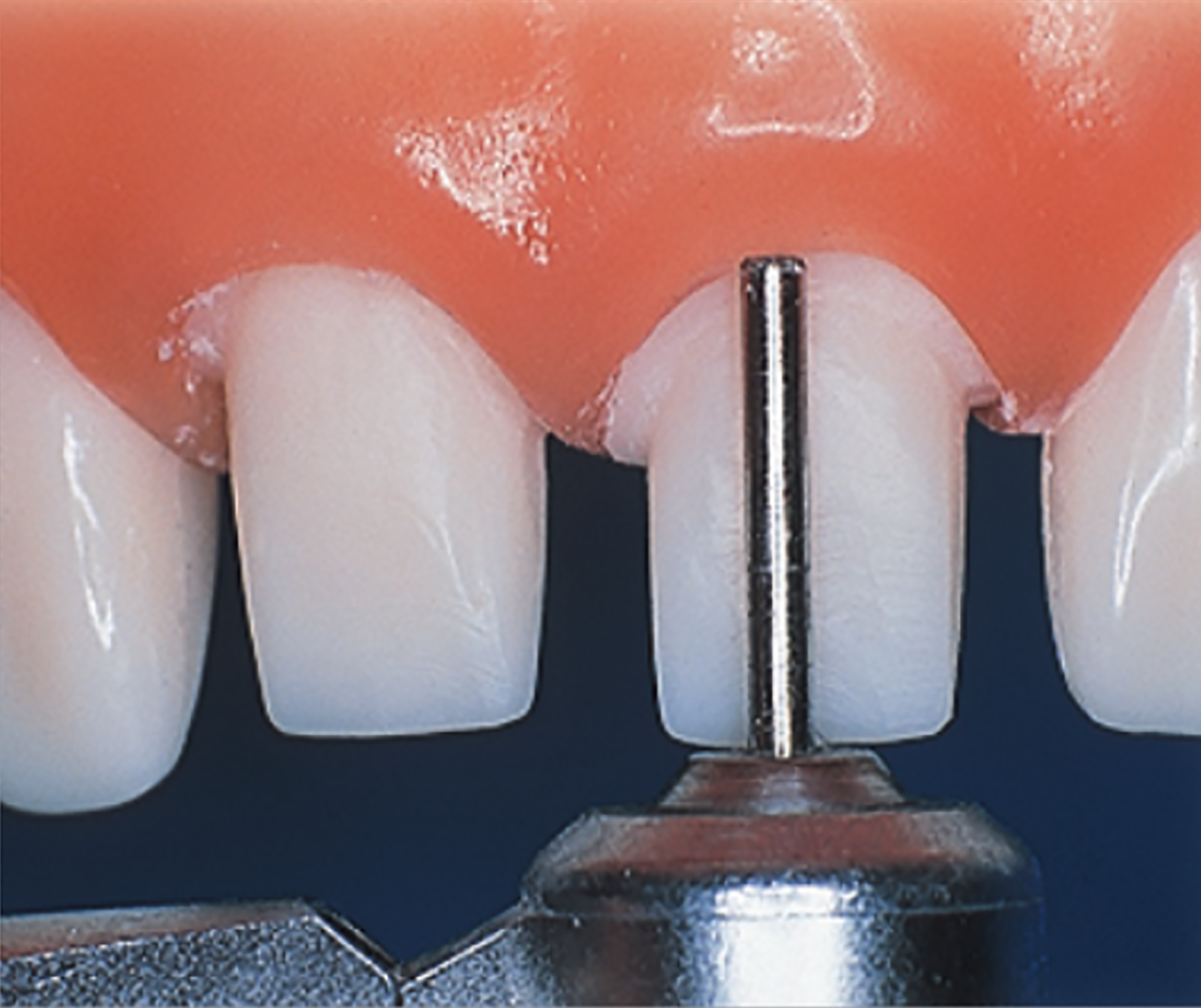 839 - End Cutting