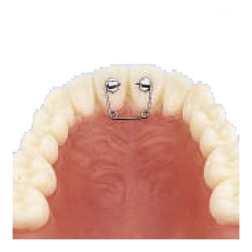 Diastema Kit