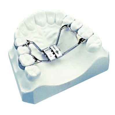 Rapid Expander With Telescopic Guides